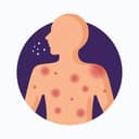 Allergy Tracker: Allergic